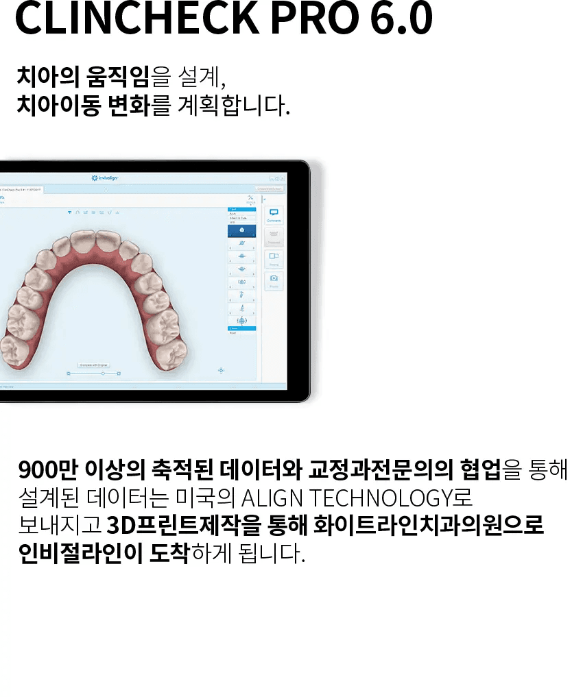 Invisalign 12