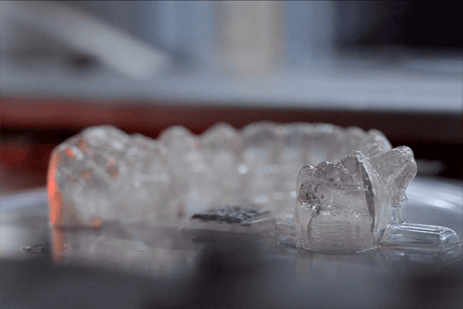 Invisalign Process 1