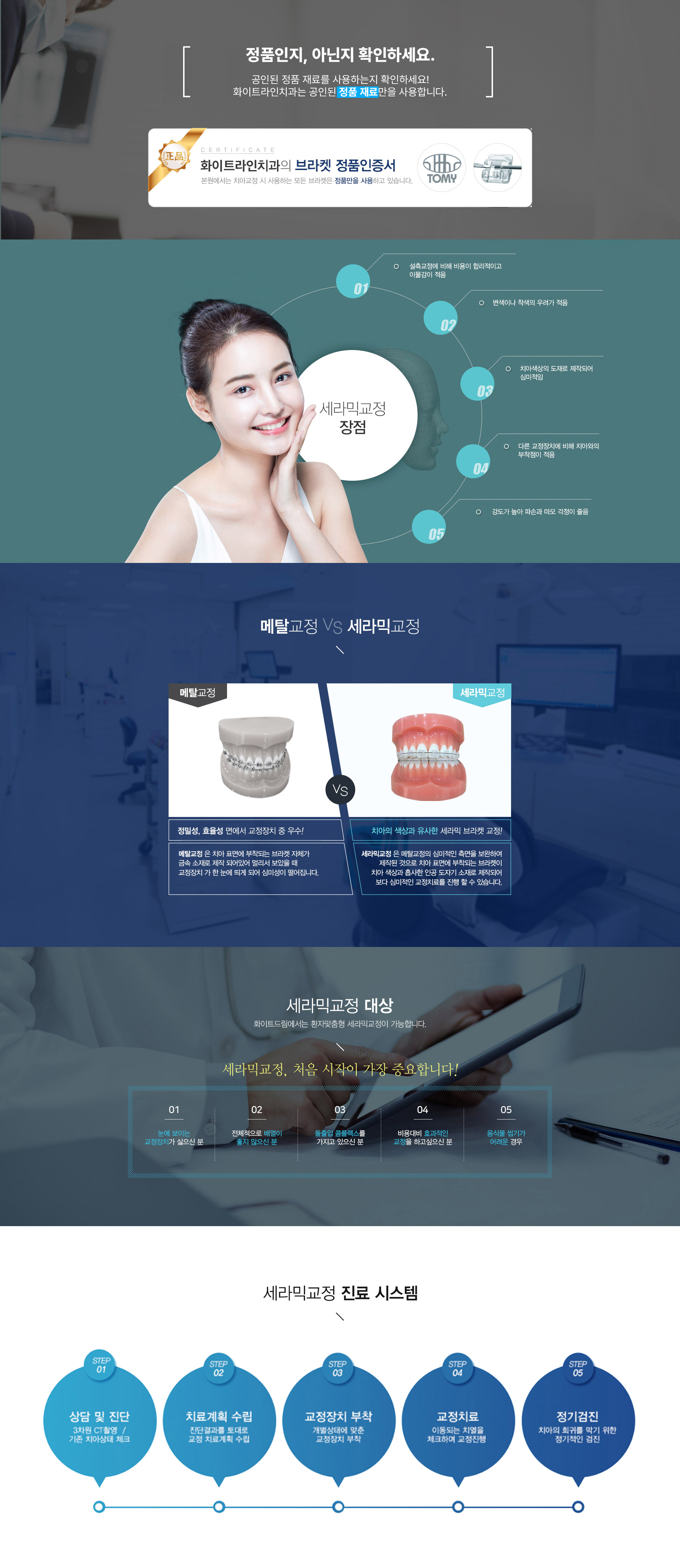 세라믹교정 03