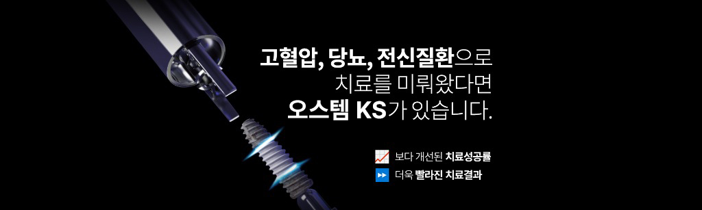UV 임플란트 소개