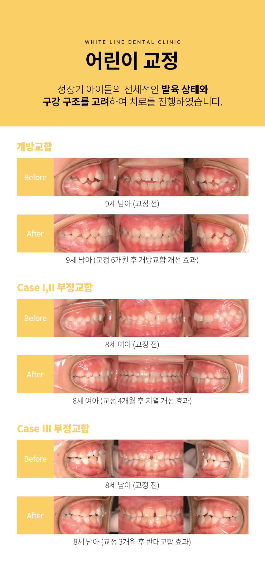 어린이교정 07