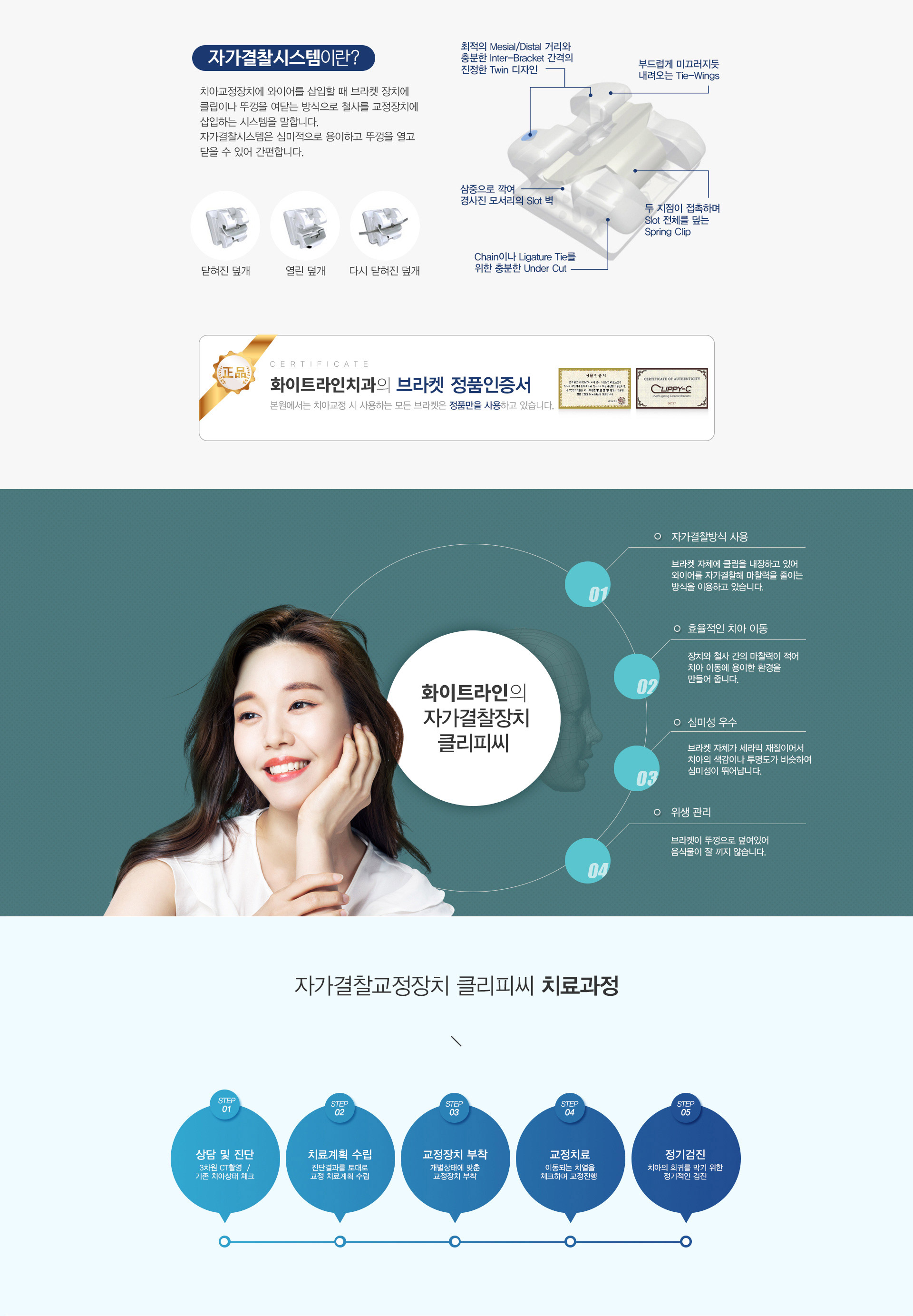 자가결찰교정 03