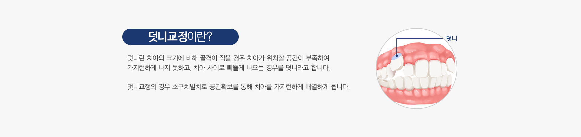 증상별교정 03