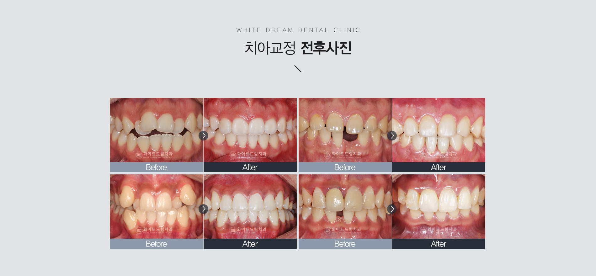 티끌교정 04