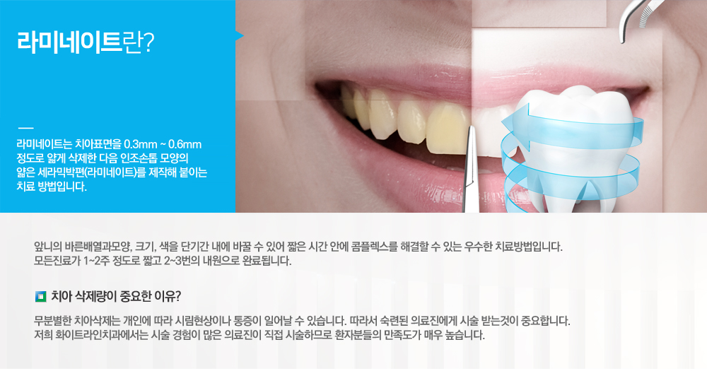라미네이트 1