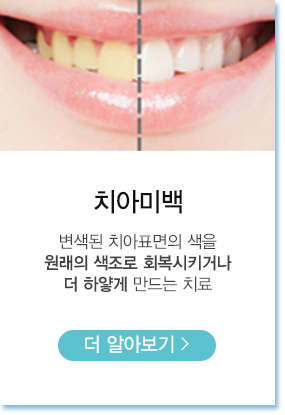 치아미백