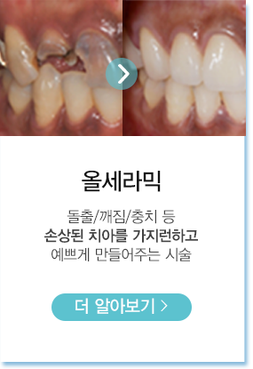 올세라믹