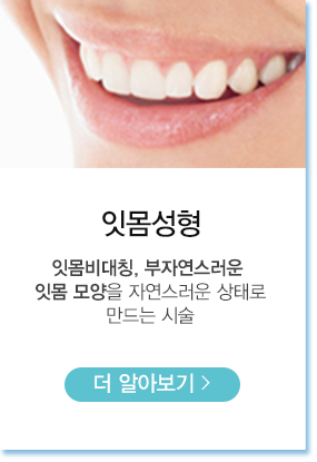 잇몸성형